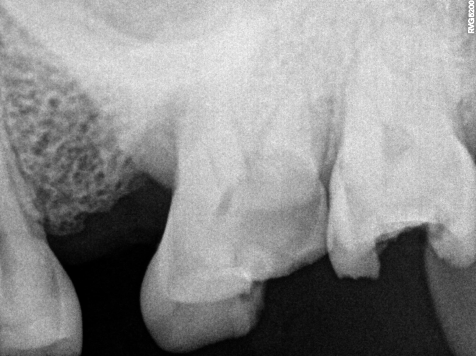 Dental X-ray